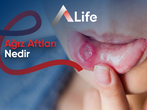 AFT (Küçük Yaraların Büyük Rahatsızlığı)