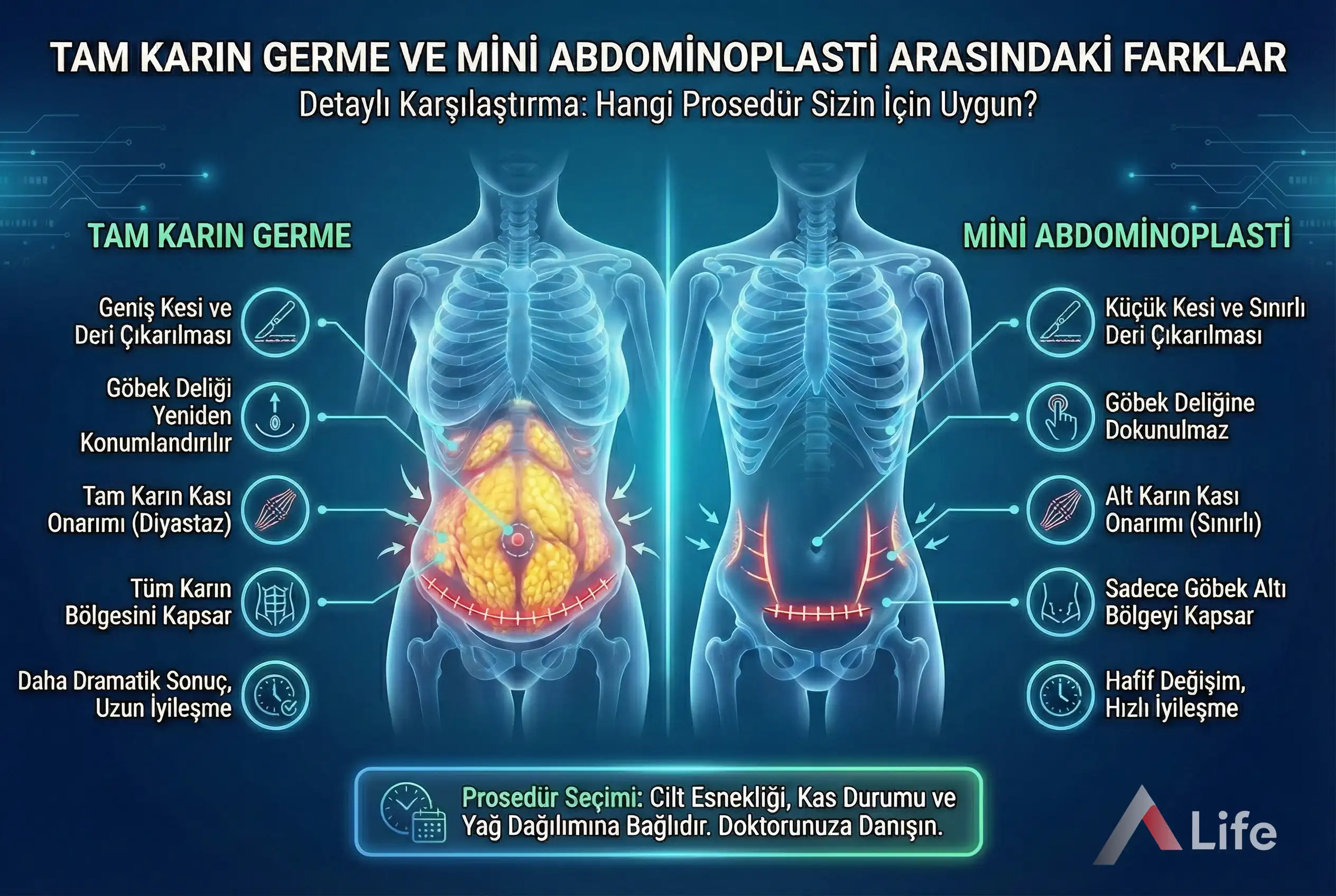 Abdominoplasti-nedir-karin-germe-ameliyati-a-life-ankara_78dab8d3.webp