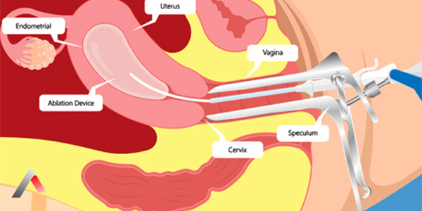 Gozal trans qiz yubka, jinsiy olatni, libos, fotosessiya, porno