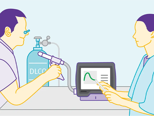 DLCO_Nedir_47a8c505.webp