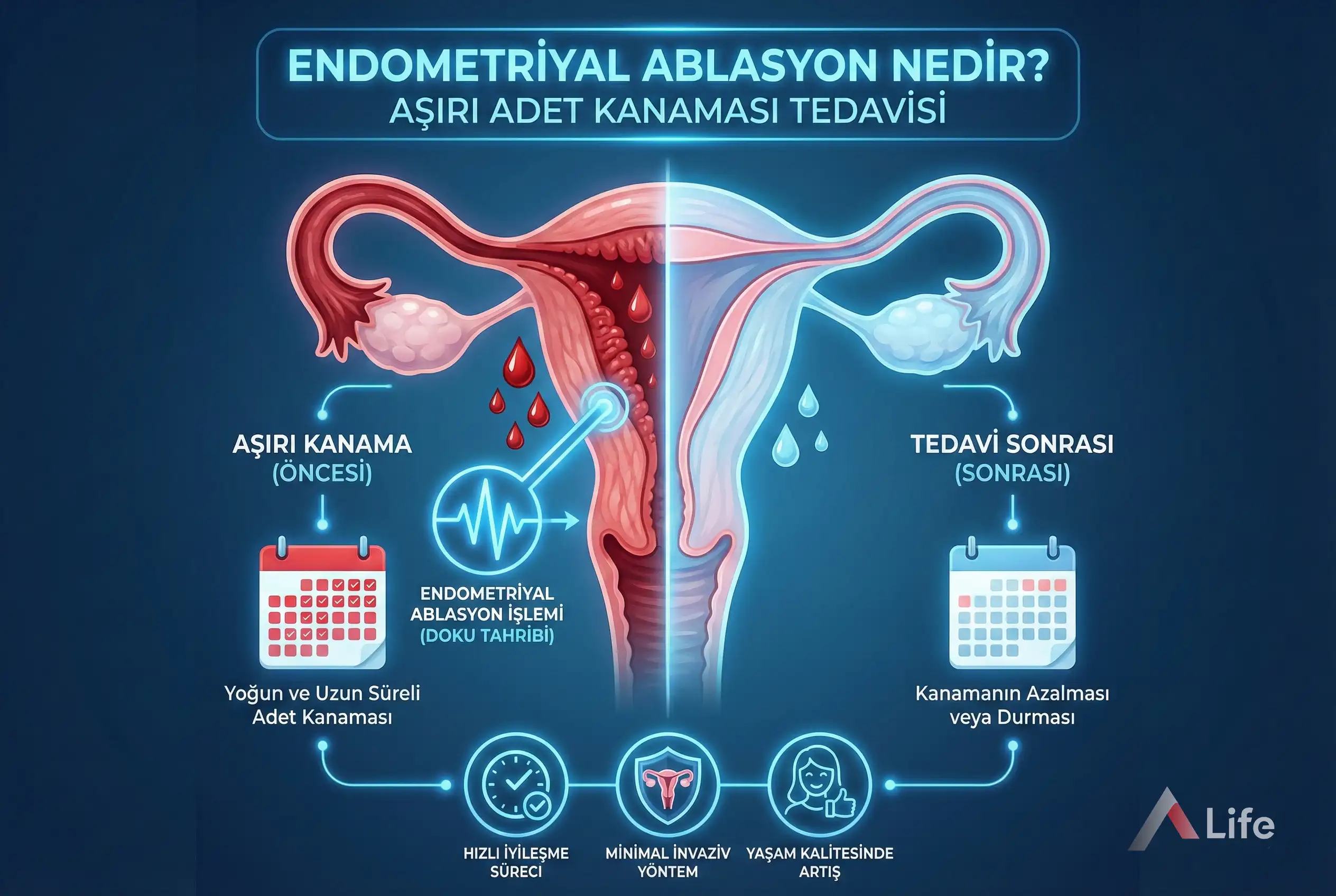 Endometriyal-Ablasyon-a-life-ankara_96bc938d.webp