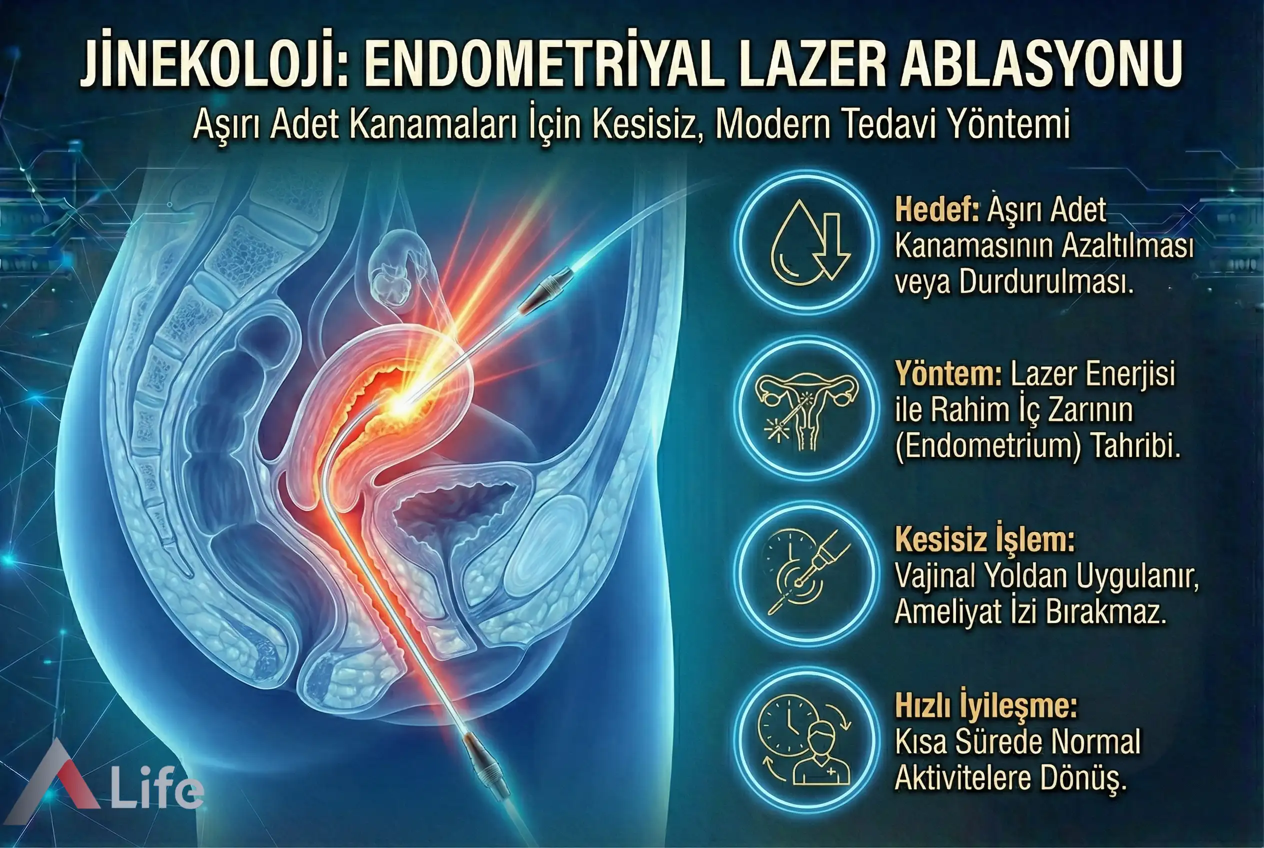 Endometriyal-lazer-ablasyon-nedir-a-life-ankara_13b3294d.webp