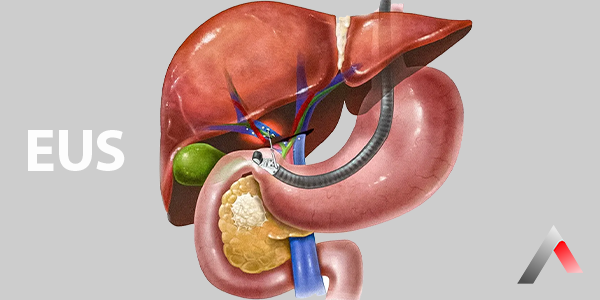 Endosonografi_dbe9ecfe.webp