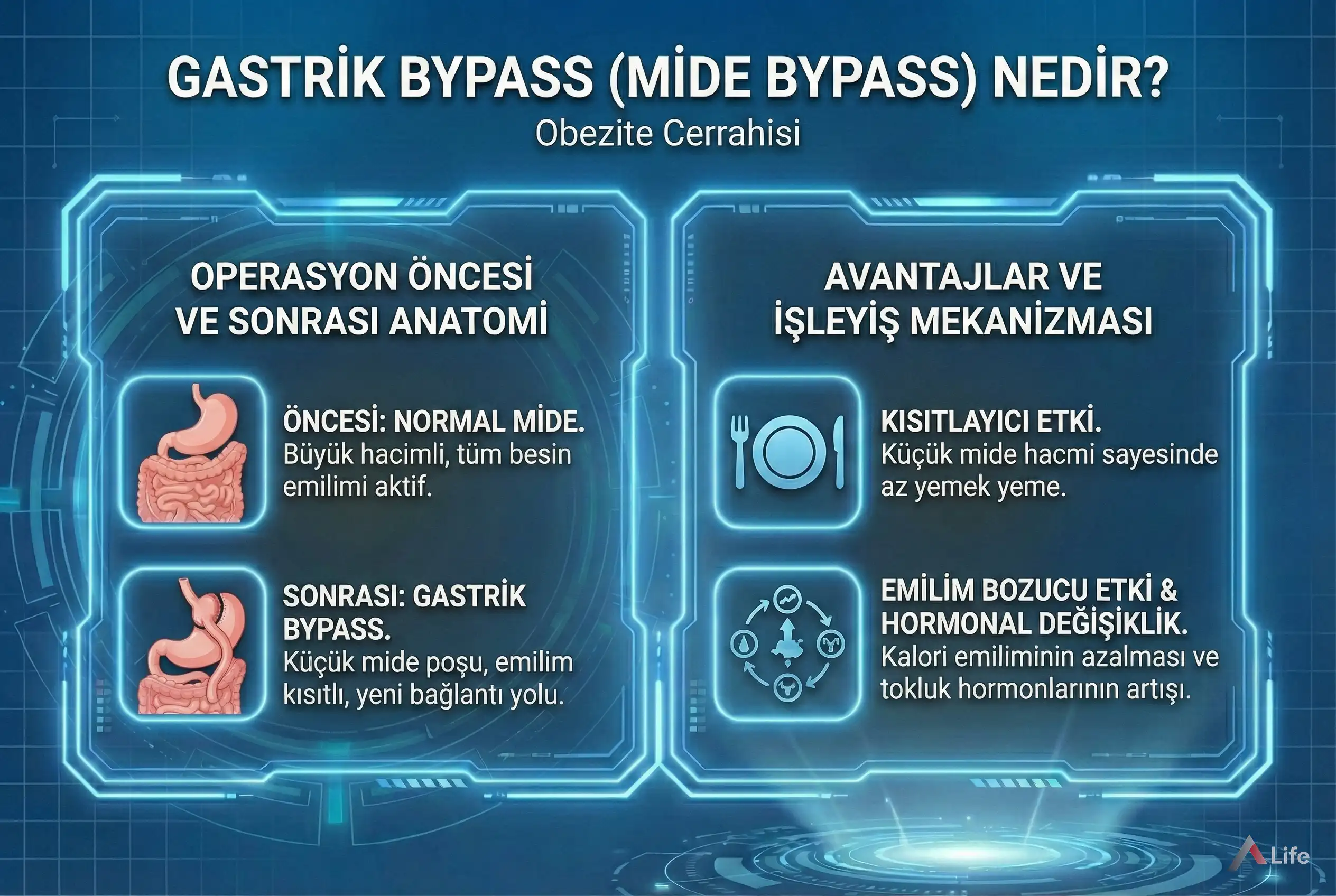 Gastrik-Bypass-a-life-ankara_78d2e9f4.webp