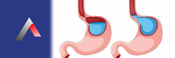 Gastro__zofageal_Refl___Hastal_______74dbeb7e.webp