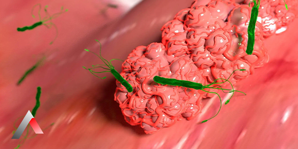 Helicobacter_Pylori_Nedir_d2910a55.webp