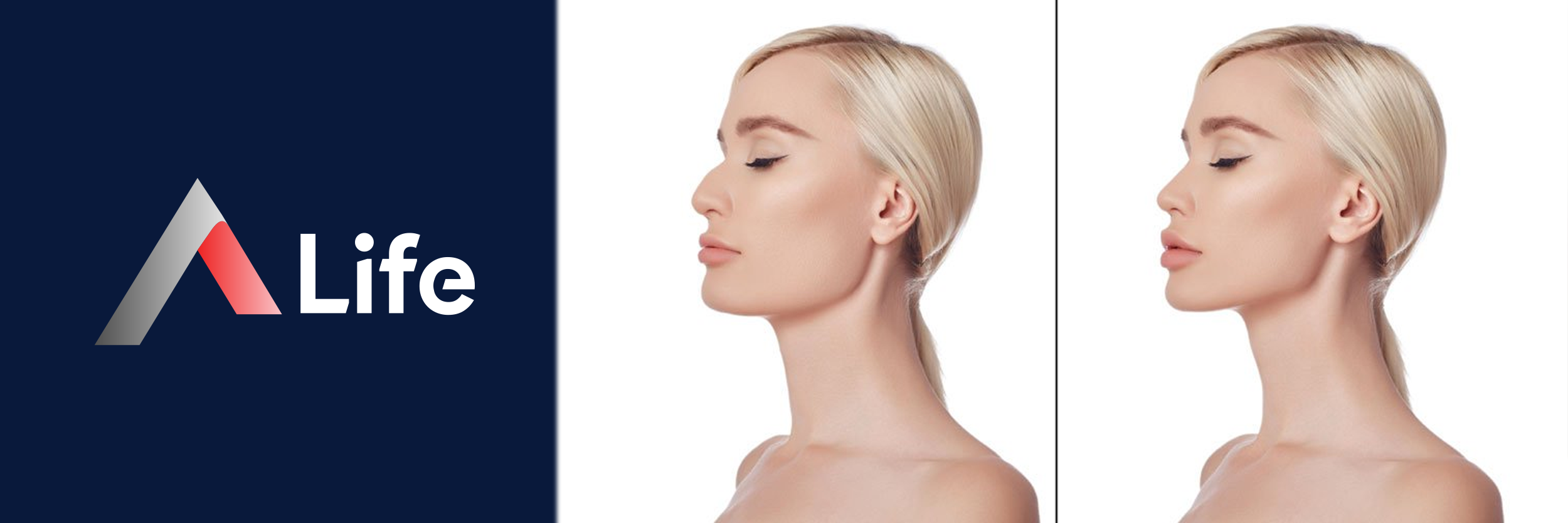 Jawline___ene_Dolgusu_25c76cb7_0f772214.webp