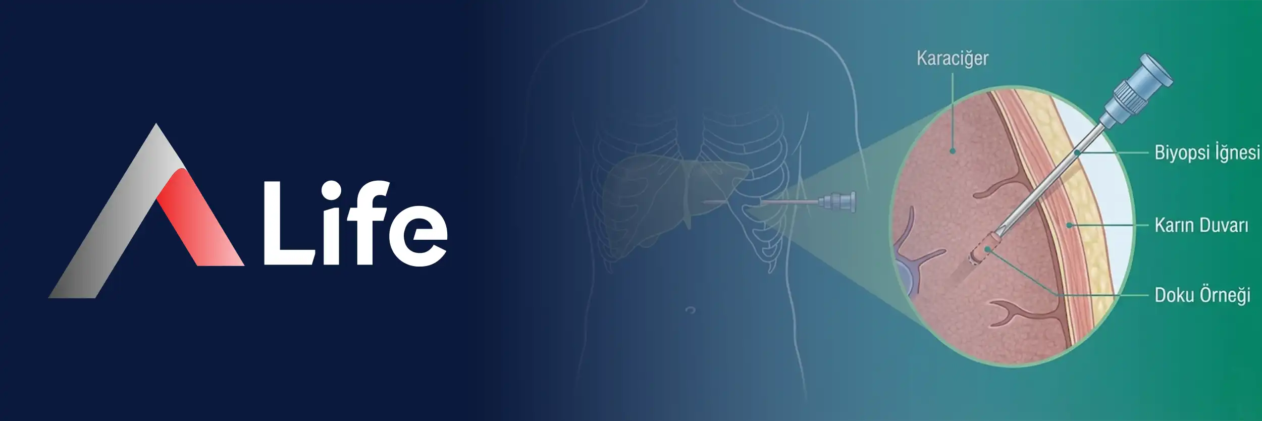 Karaciger-biyopsisi-a-life-ankara_4c54ad76.webp