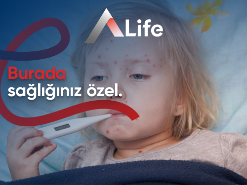 Kızamık Belirtileri