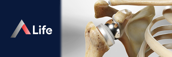 Omuz-protezi-ameliyati-a-life-ankara_029d4c98.webp