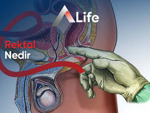 Rektal Nedir?