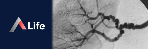 Renal_Angiography_ce8abead.webp
