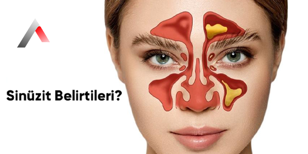Sin__zit_Belirtileri_06163a55.webp