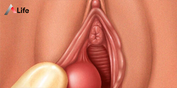 Jojalarning külotsiz uy qurilishi fotosuratlari