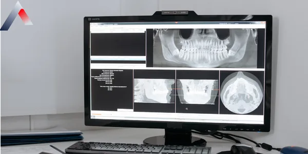 XR_-_Dijital_R__ntgen_Nedir_9b99eb50.webp