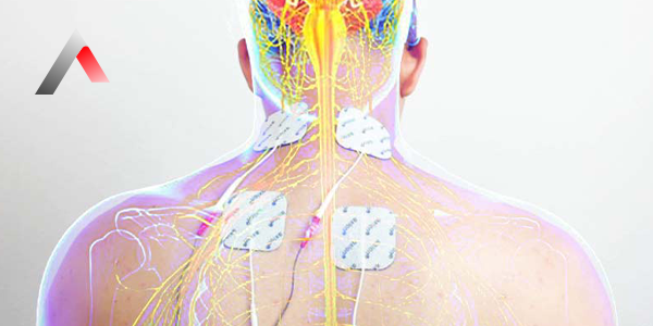 Electrical Muscle Stimulation (EMS): Uses & Benefits