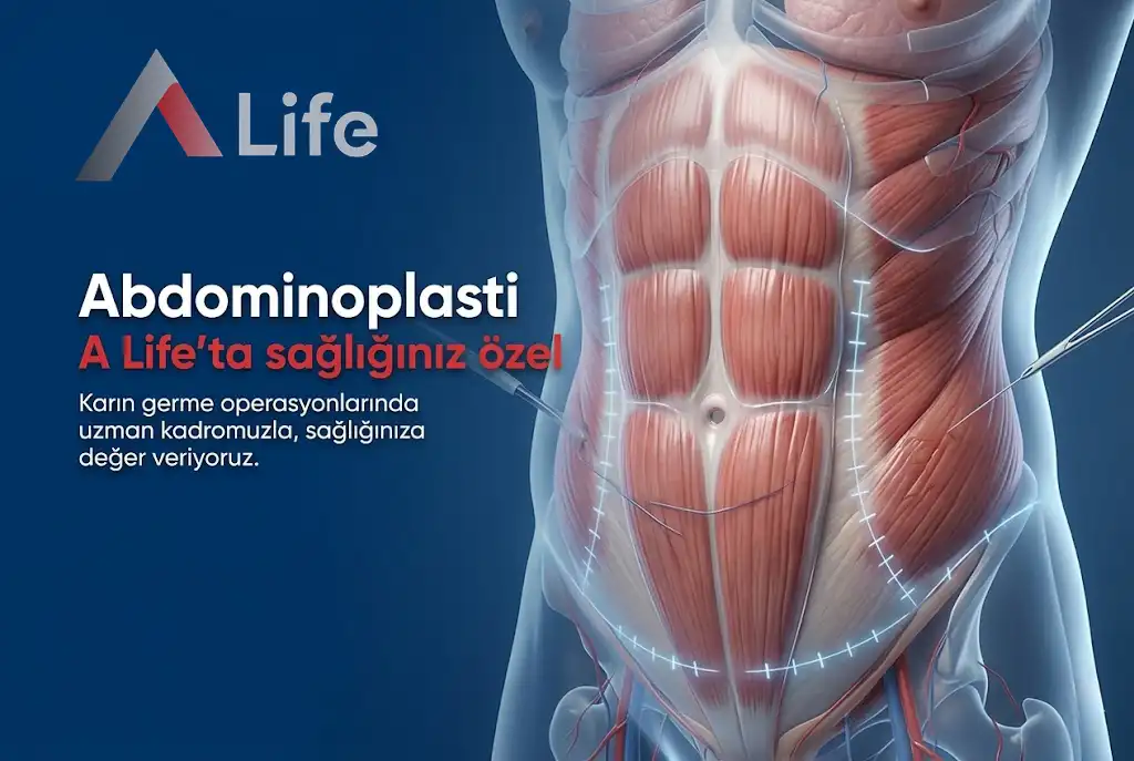 Abdominoplasti