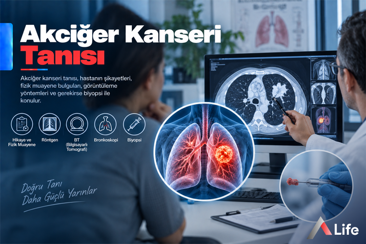 akciger-kanseri-tanisi_8654f722.webp