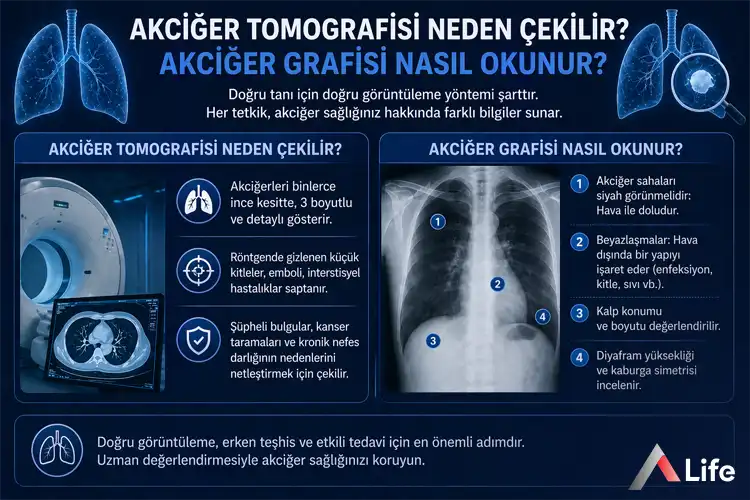 akciger-tomografisi-neden-cekilir_83abdf59.webp