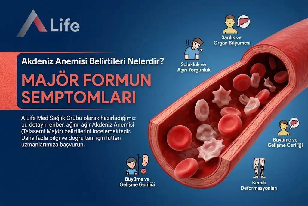 akdeniz-anemisi-belirtileri-a-life-ankara_cb538ff1.webp