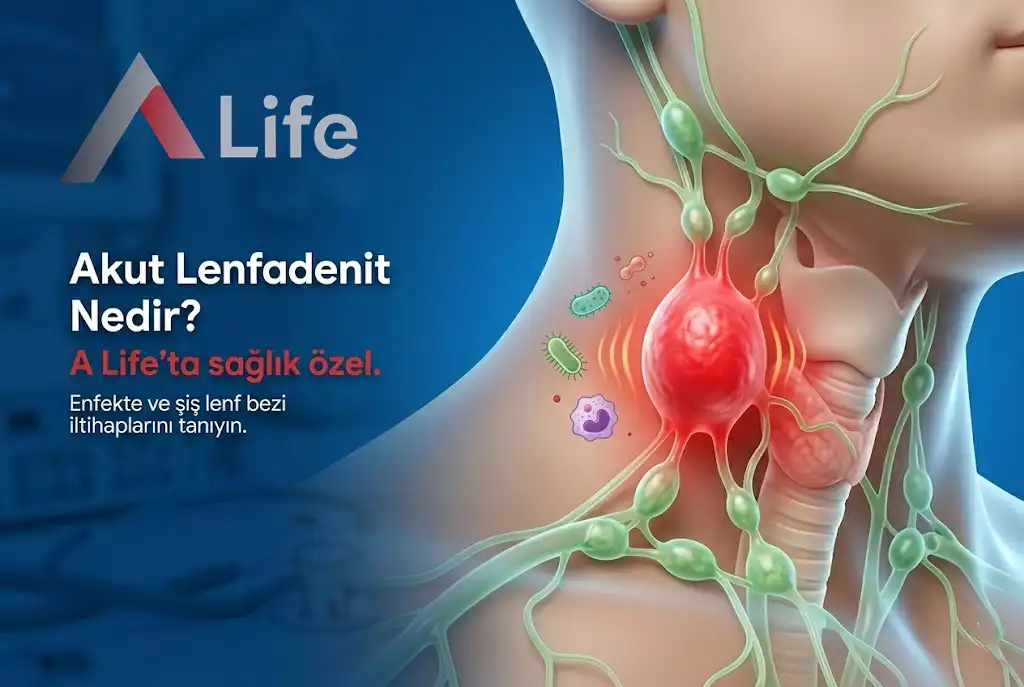 Akut Lenfadenit Nedir?