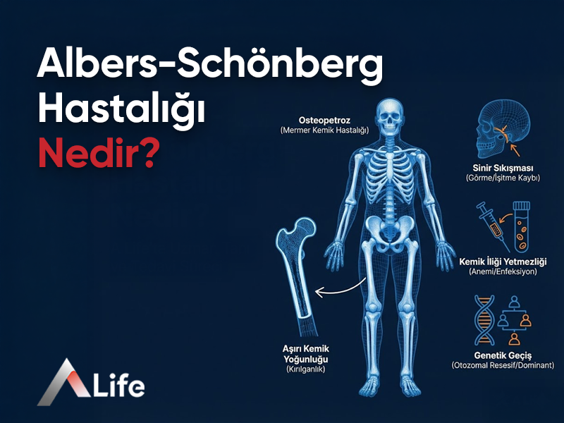 Albers-Schönberg Hastalığı Nedir ?