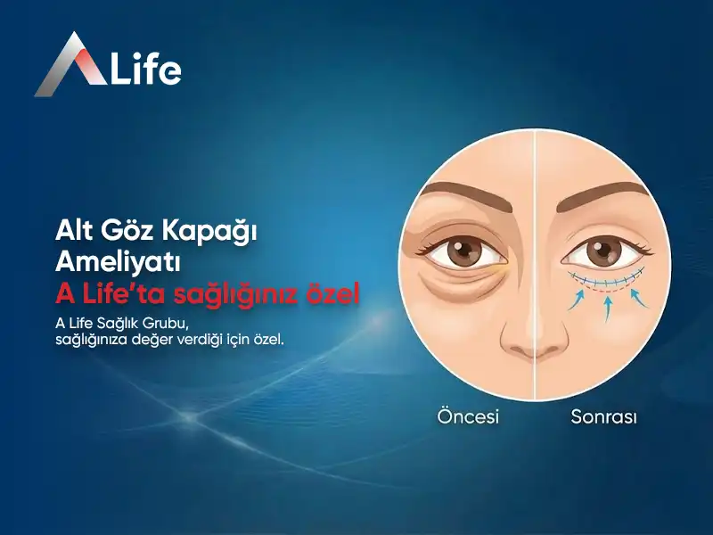 Alt Göz Kapağı Ameliyatı