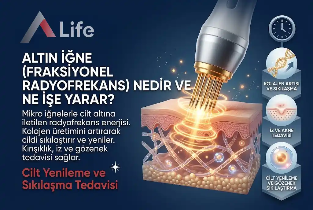 altin-igne-fraksiyonel-radyofrekans-nedir-a-life-ankara_74153ef1.webp
