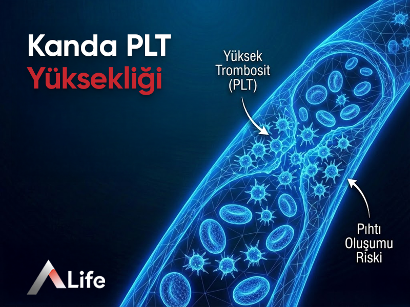 Kanda PLT Yüksekliği