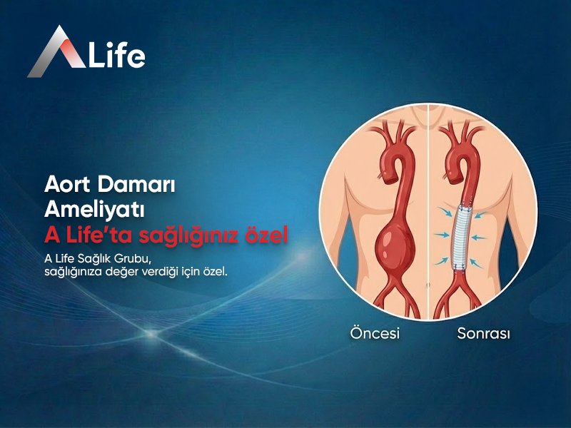 Aort Damarı Ameliyatı
