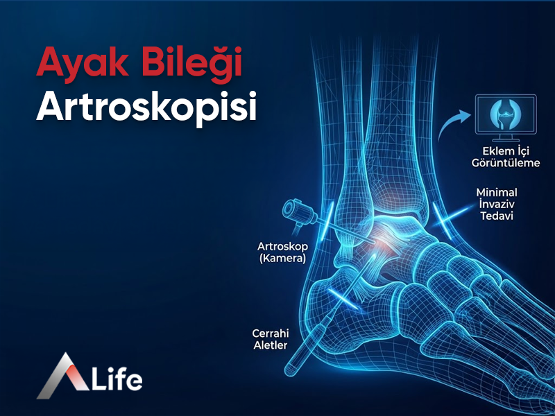 Ayak Bileği Artroskopisi