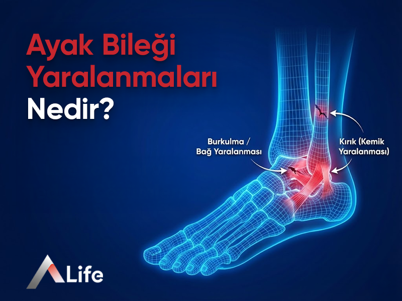 Ayak Bileği Yaralanmaları Nedir ?