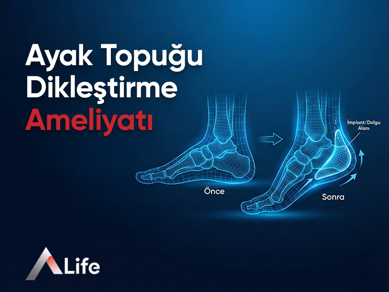 Ayak Topuğu Dikleştirme Ameliyatı