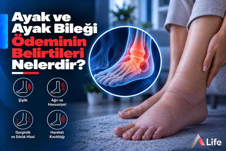 ayak-ve-ayak-bilegi-odeminin-belirtileri-nelerdir_980800e5.webp