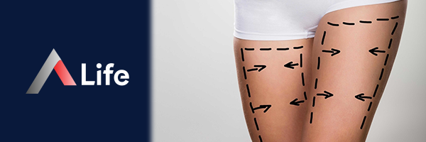 bacak_liposuction____5de354e3.webp