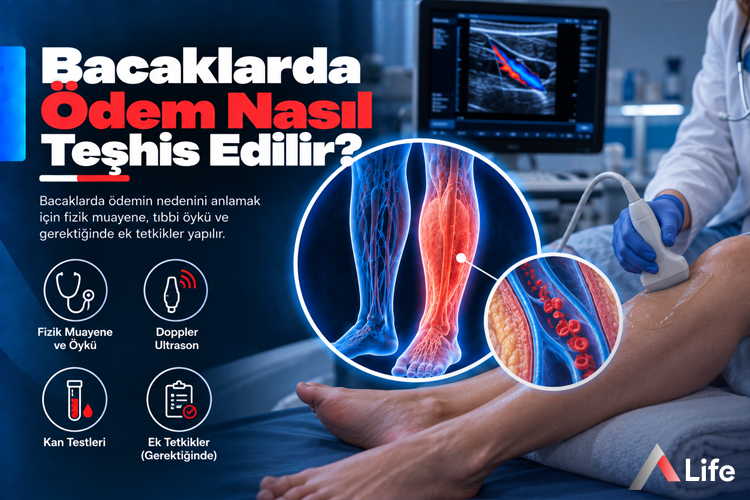 bacaklarda-odem-nasil-teshis-edilir_9c5c0b49.webp