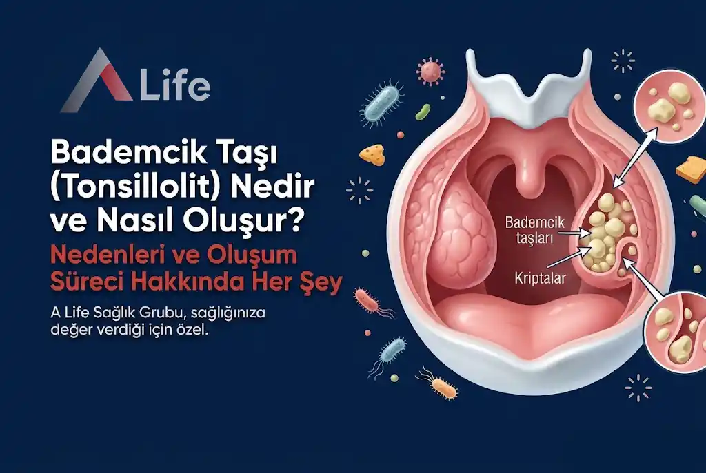 bademcik-tasi-tonsillolit-nedir-nasil-olusur-a-life-ankara_3ca497ee.webp