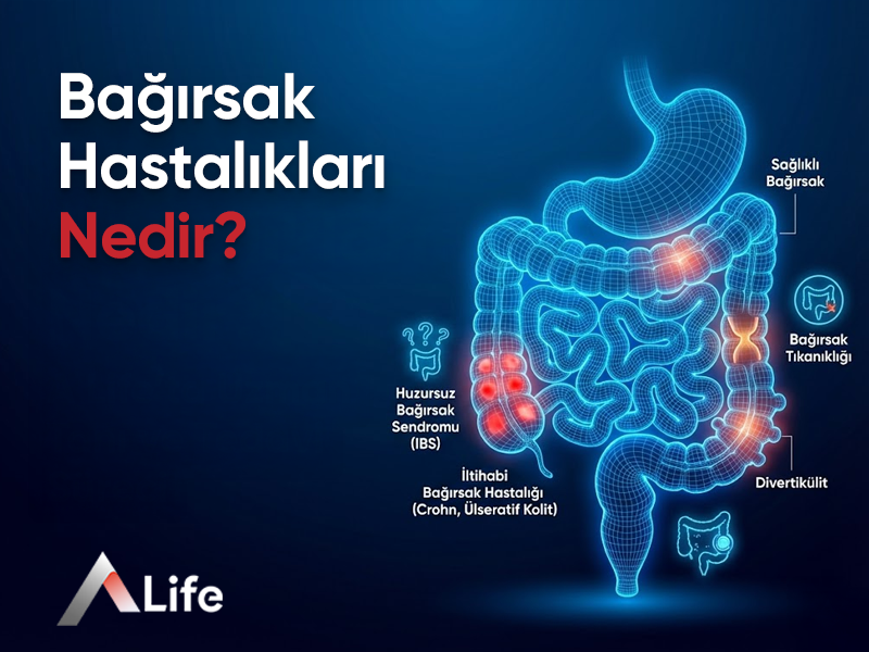 Bağırsak Hastalıkları Nedir ?