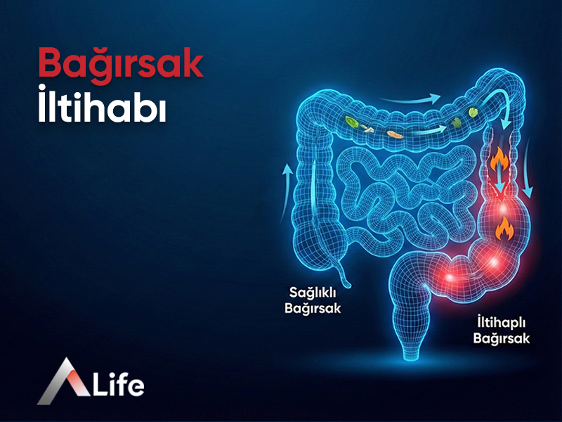 Bağırsak İltihabı: Sağlıklı Bir Sindirim Sistemi