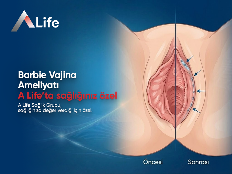 Barbie Vajina Ameliyatı