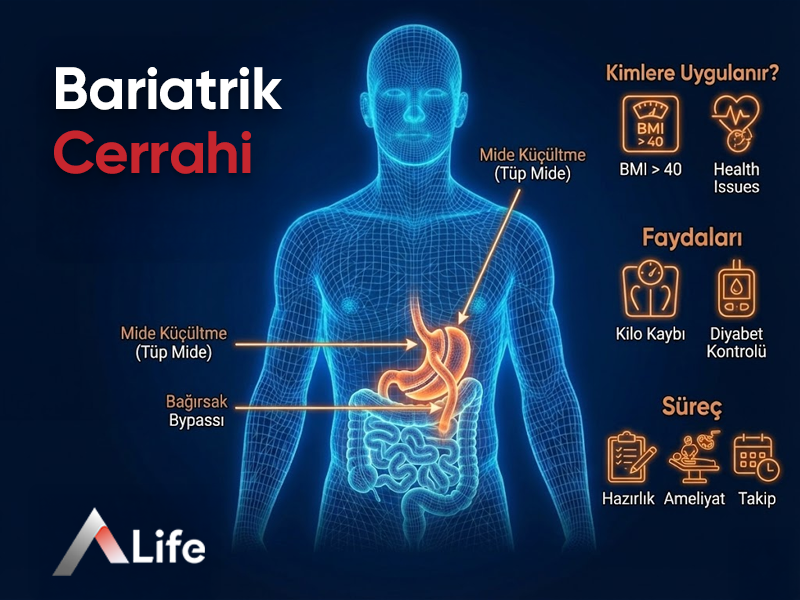 Bariatrik Cerrahi
