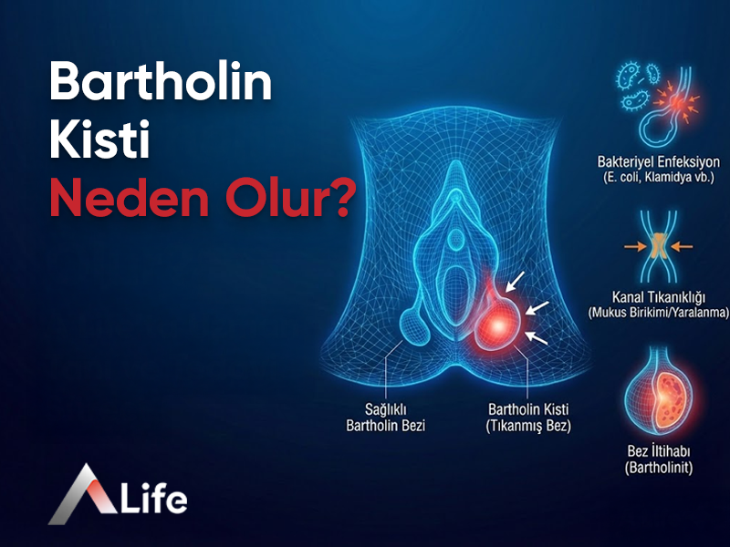 Bartholin Kisti Neden Olur?
