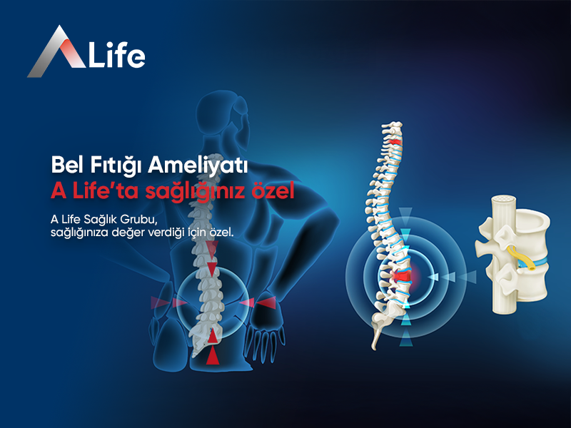 Bel Fıtığı Ameliyatı