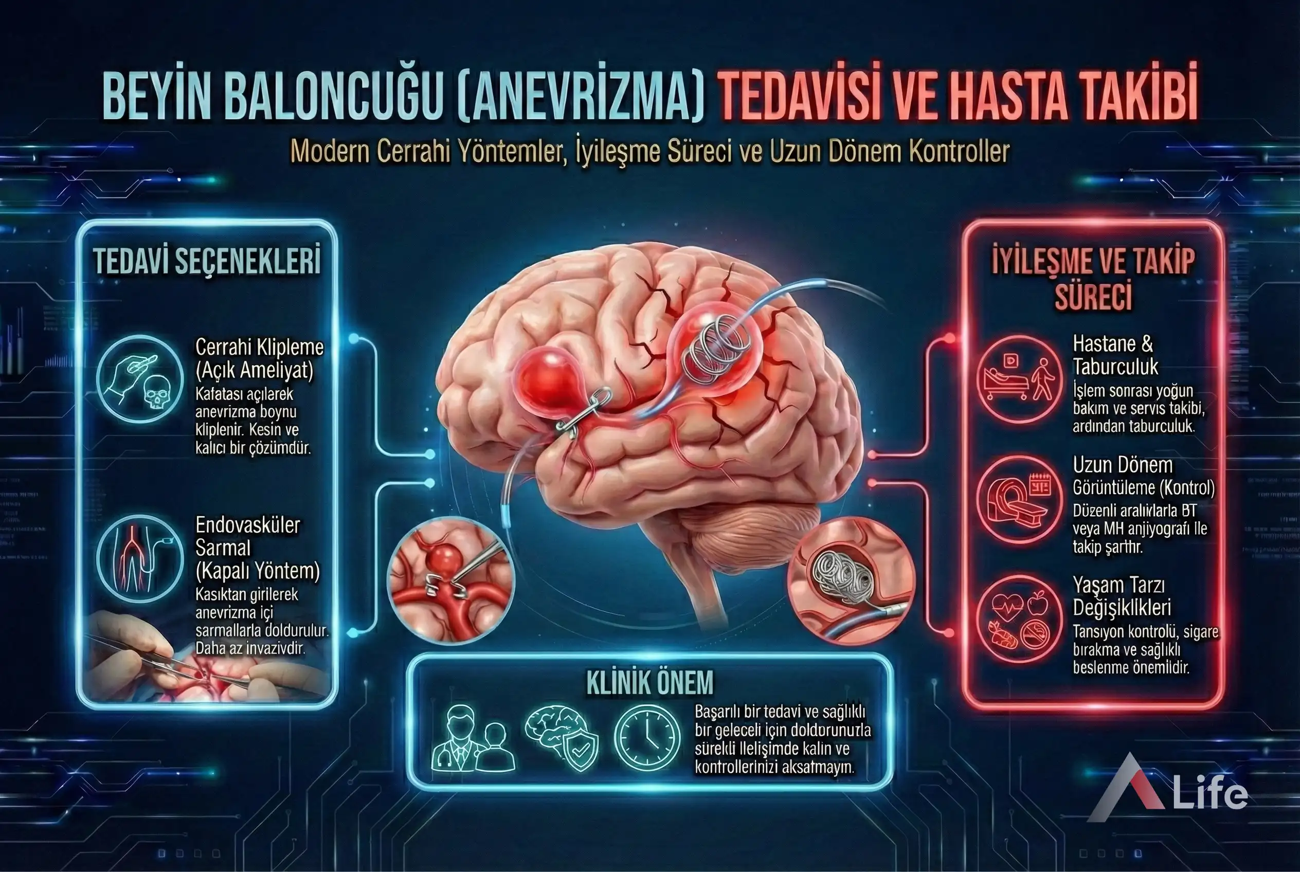 beyinde-baloncuk-anevrizma-a-life-ankara_9623e5e3.webp