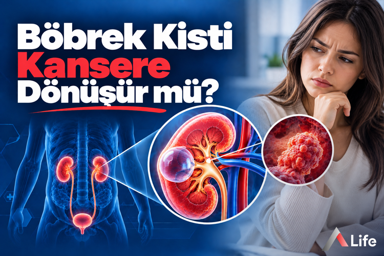 bobrek-kisti-kansere-donusur-mu_8192ba82.webp