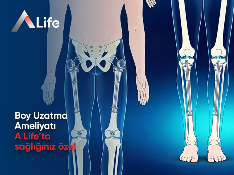 Boy Uzatma Ameliyatı