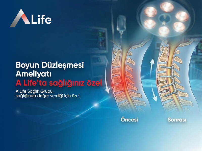 Boyun Düzleşmesi Ameliyatı