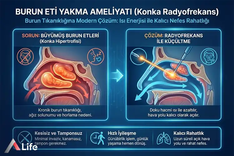 burun-eti-yakma-ameliyati_84884b44.webp