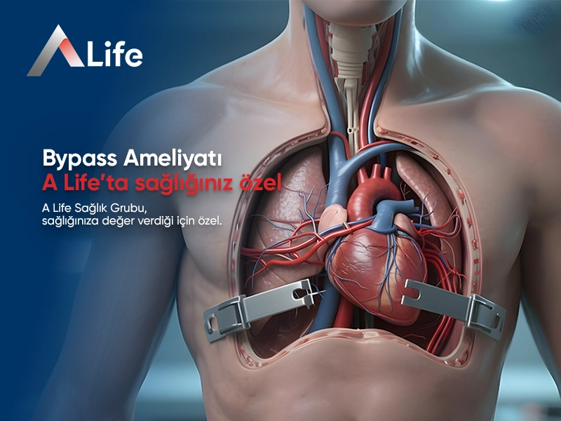 Bypass Ameliyatı