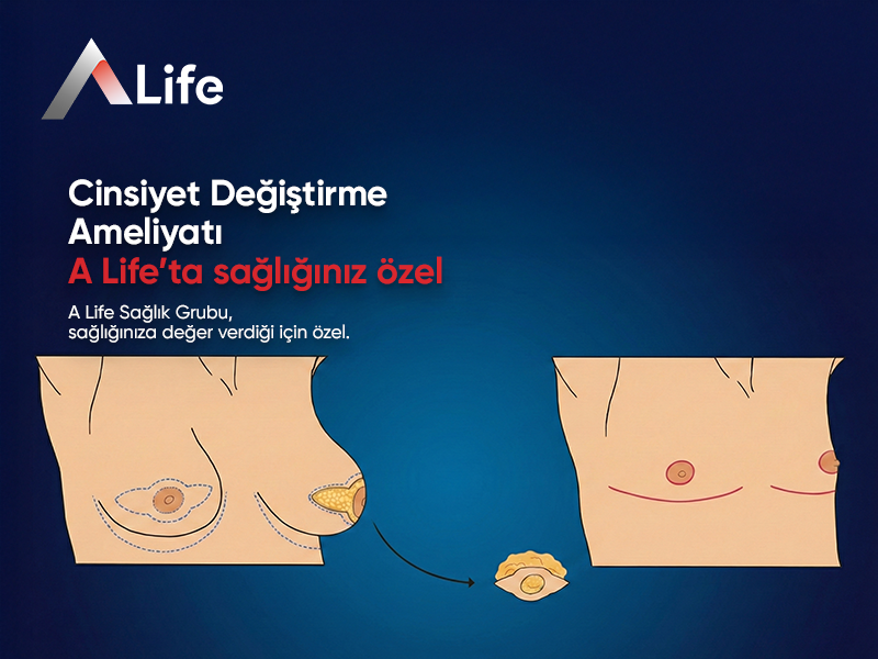 Cinsiyet Değiştirme Ameliyatı